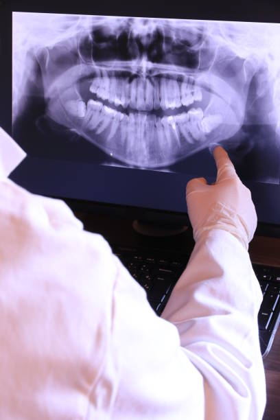 Best Emergency Wisdom Teeth Removal in Collinsville, CT